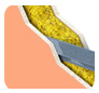 Resilmount